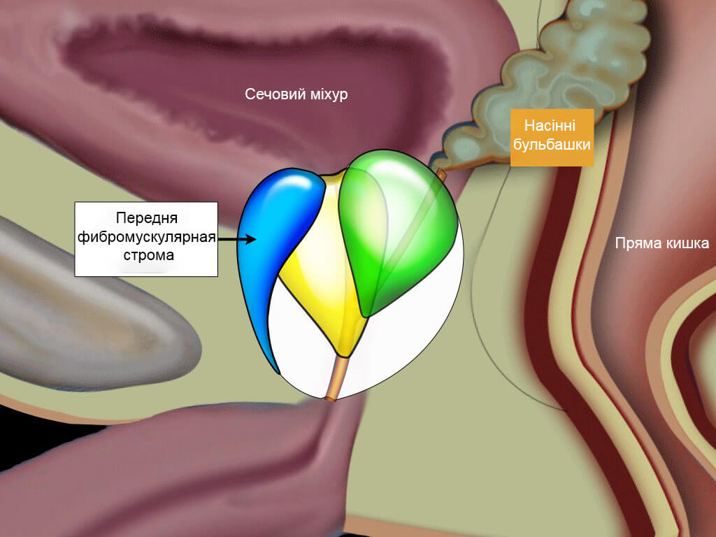 Предстательная железа переходная зона. Фибромускулярная Строма предстательной железы это. Переходная зона предстательной железы. Зональная анатомия предстательной железы. Зональная анатомия предстательной железы УЗИ.