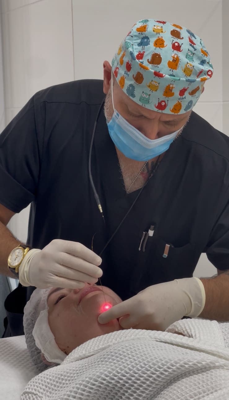 Фракційне неабляційне омолодження шкіри Endolift